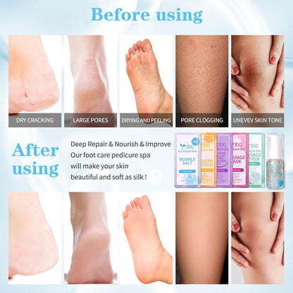 Pedicure Kit Foot Soak Set: Bubble Salt, Sugar Scrub, Massage Mask, Massage Lotion in a Box, 4 Step Foot Spa Kit for Dry Feet, Softens Calluses, Tired Feet（3 Set Lavender) - Colors B