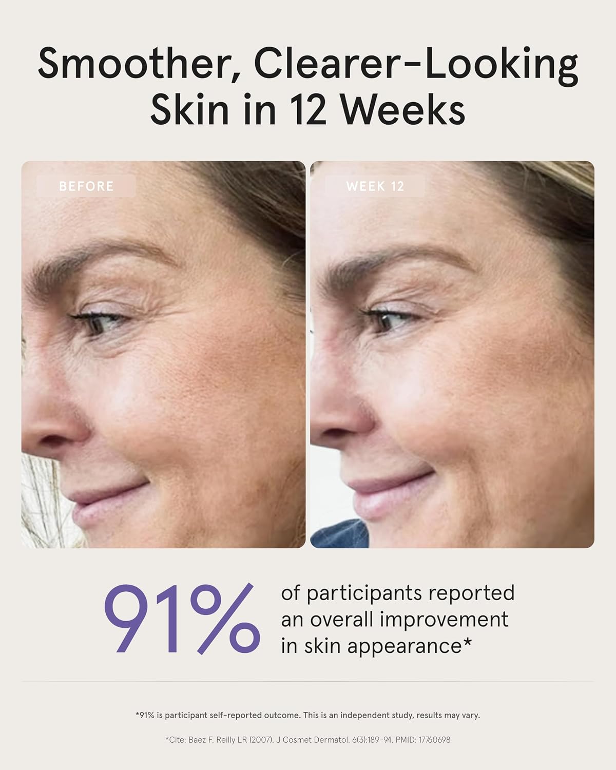 iRestore LED Face Mask for Youthful Skin, Red Light Therapy for Face, Red, Blue & Infrared Therapy for Wrinkles, Fine Lines, Dark Spots with 360 LEDs, Skincare Device for Women & Men