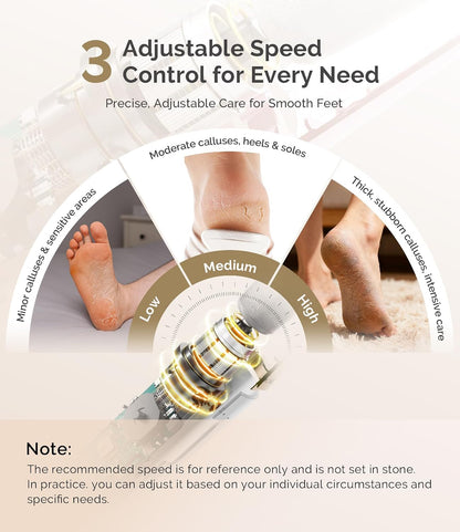 MelodySusie Electric Callus Remover for Feet, PC800G Waterproof Rechargeable Pedicure Tool with Light & 3 Different Grits Roller Heads & Adjustable Speeds, for Dead Skin & Cracked Heel (Pink Rose)