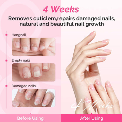 MelodySusie 16Pcs Professional Nail Buffer Kit,Nail Files and Buffers,Nail Buffer Block,Nail Brush, Nail File Buffers Kit for Natural Nails,DIY,Home Use,Salon（100/180 Grit）
