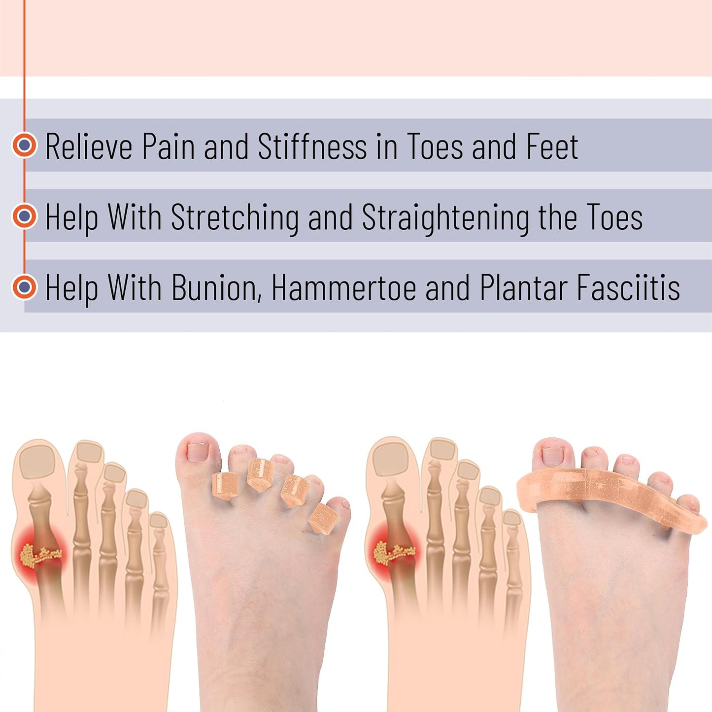 DR. JK- ToePal Gel Toe Separator, 2 Pairs, Toe Spacers, Toe Straightener, Hammer Toe Straightener, Toe Spreader, Toe Stretcher, Toe Corrector for Women and Men, Bunion Corrector