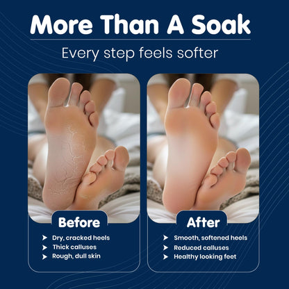Imperial Feet Epsom Salt Foot Soak (PEDICURE GRADE)-Toenail Repair, Fungus Athletes Foot, Softens Calluses, Tired Feet & Nail Discoloration Foot Soak Salts with Tea Tree Oil 16oz (Green Fungal)