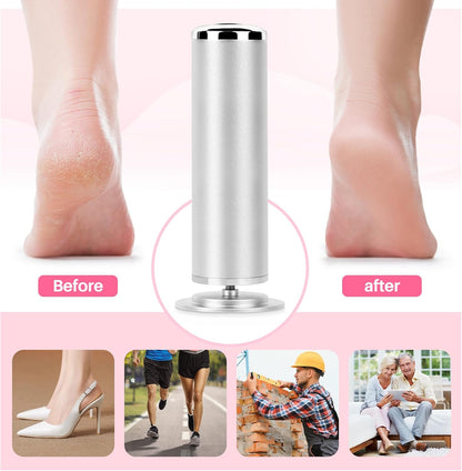 LIONVISON Electric Foot Callus Remover: Adjustable Speed Foot File for Cracked Heels - Working Women's Summer Pedicure Tool with 60pcs Sandpaper Discs - Dead Skin Remover for Dry Feet at-Home