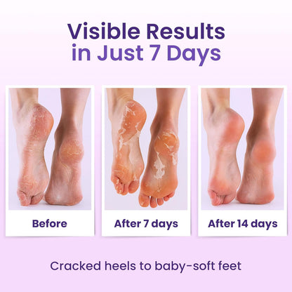 BLOOMORA Foot Peeling Mask (6 pairs) Exfoliating Foot Mask for Dry Cracked Feet with Lavender & Shea Butter, Dead Skin & Callus Remover for Feet, Exfoliating Socks for Women & Men, One Size Fits Most
