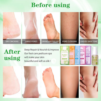 Pedicure Kit Foot Soak Set: Bubble Salt, Sugar Scrub, Massage Mask, Massage Lotion in a Box, 4 Step Foot Spa Kit for Dry Feet, Softens Calluses, Tired Feet（3 Set Lavender) - Colors A
