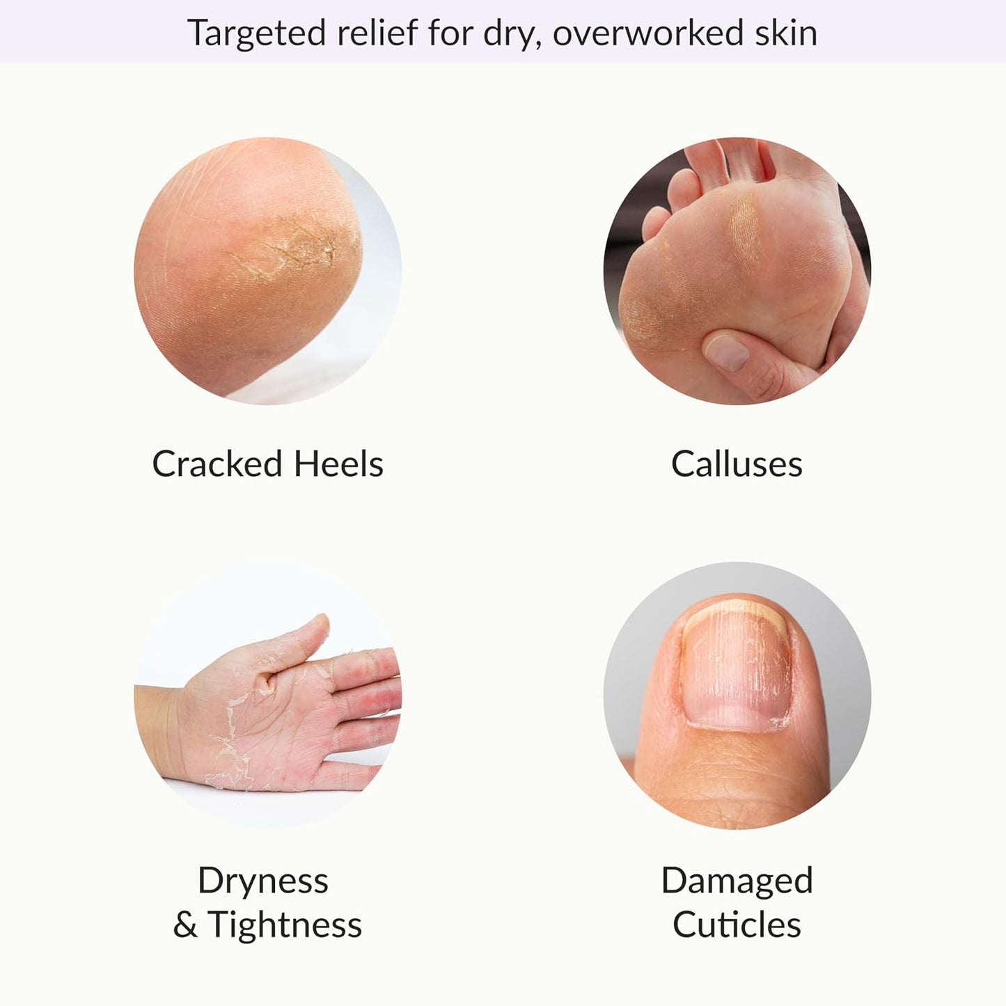 Epielle Foot Peel Mask | 2 Pairs | For Cracked Heels, Dead Skin & Calluses | Smooth & Repair Rough, Dry Skin | Beauty Gift, Spa Day, Gift Set | Korean Skincare