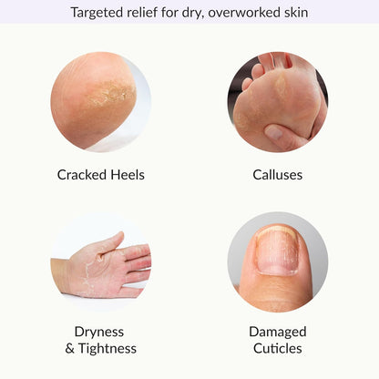 Epielle Foot Peel Mask | 2 Pairs | For Cracked Heels, Dead Skin & Calluses | Smooth & Repair Rough, Dry Skin | Beauty Gift, Spa Day, Gift Set | Korean Skincare