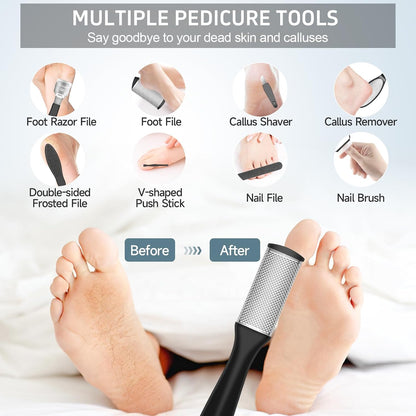 Electric Callus Remover for Feet,Professional Pedicure Kit Rechargeable Foot File Hard Skin Remover for Cracked Heels &Dead Skin,with 3 Roller Heads 2 Speed(White N9)