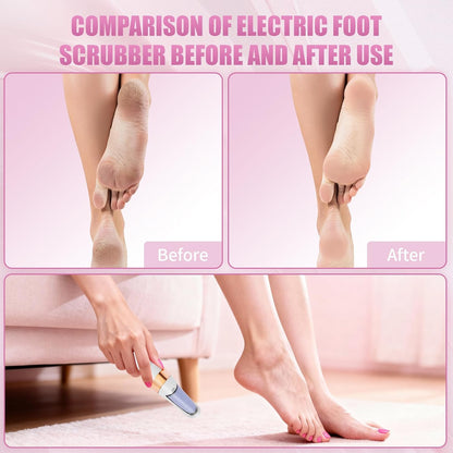 Pedicure Tool, Foot Callus Remover, Electric Pedicure Set, Foot Care, Removes Rough Dead Skin on The Feet, Making Your Feet Smooth. (Pink)