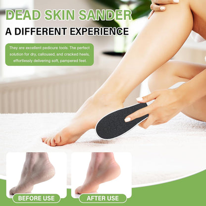 10 Pack Foot File,Foot Callus Remover Professional Sandpaper Pedicure Tools, Double Side Foot Scrubber, Sander for Dead Skin Foot Rasp Pedicure for Women Mother Manicure Beauty Shop Spa