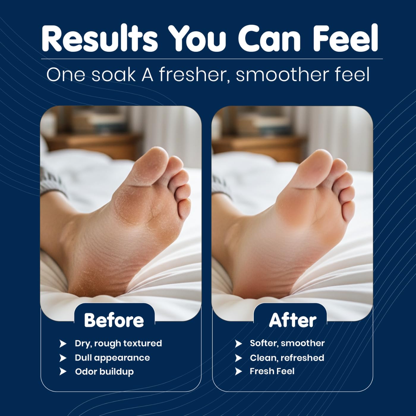 Imperial Feet Epsom Salt Foot Soak (PEDICURE GRADE)-Toenail Repair, Fungus Athletes Foot, Softens Calluses, Tired Feet & Nail Discoloration Foot Soak Salts with Tea Tree Oil 16oz (Green Fungal)