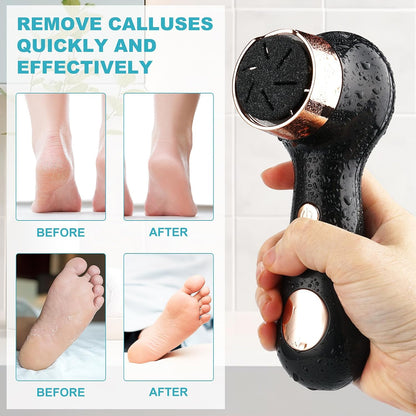 Callus Remover for Feet, Nicebirdie Electric Foot File Callus Removers Rechargeable Waterproof Pedicure Tools Foot Scrubber Shaver Feet Care Tool for Cracked Heels Dead Skin （Green）