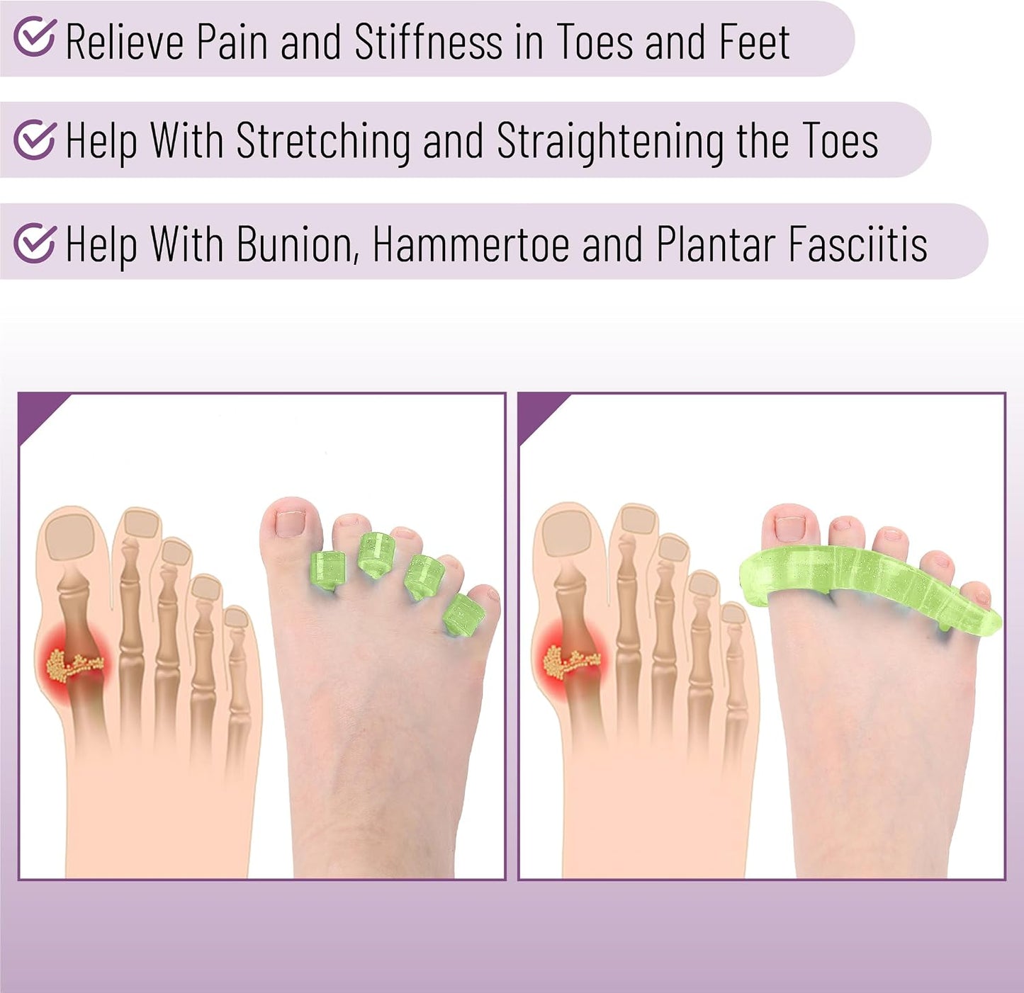 DR. JK- ToePal Gel Toe Separator, 2 Pairs, Toe Spacers, Toe Straightener, Hammer Toe Straightener, Toe Spreader, Toe Stretcher, Toe Corrector for Women and Men, Bunion Corrector
