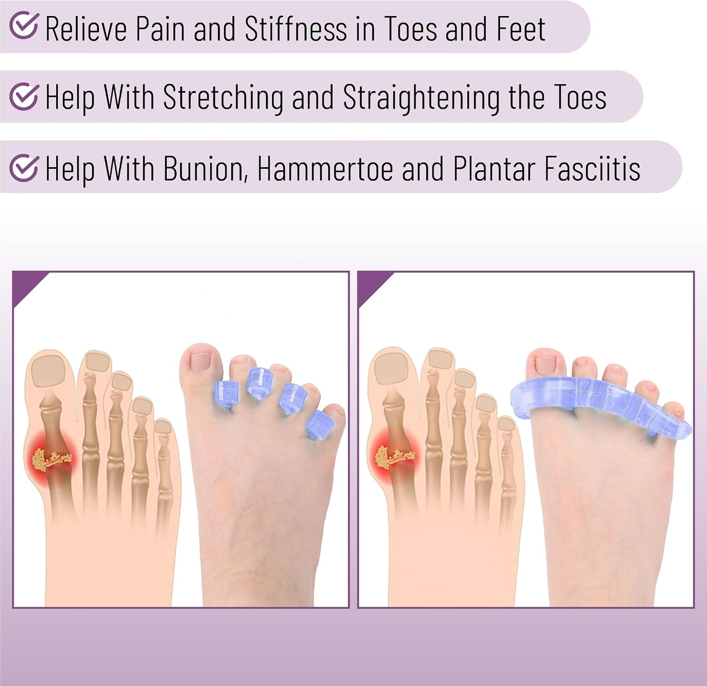 DR. JK- ToePal Gel Toe Separator, 2 Pairs, Toe Spacers, Toe Straightener, Hammer Toe Straightener, Toe Spreader, Toe Stretcher, Toe Corrector for Women and Men, Bunion Corrector