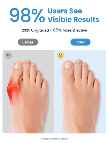 Bunion Corrector, Toe Separators for Women Men Big Toe, Breathable Toe Spacers, Bunion Correction(2PCS)