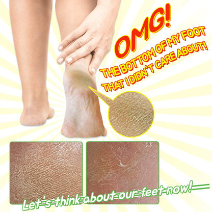 Elizavecca/Foot Peel /1 Foot Pack 2 Pairs Foot Mask - Boots for Exfoliating/foot pack review/foot pack before and after