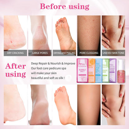 Pedicure Kit Foot Soak Set: Bubble Salt, Sugar Scrub, Massage Mask, Massage Lotion in a Box, 4 Step Foot Spa Kit for Dry Feet, Softens Calluses, Tired Feet（3 Set Lavender) - Colors B