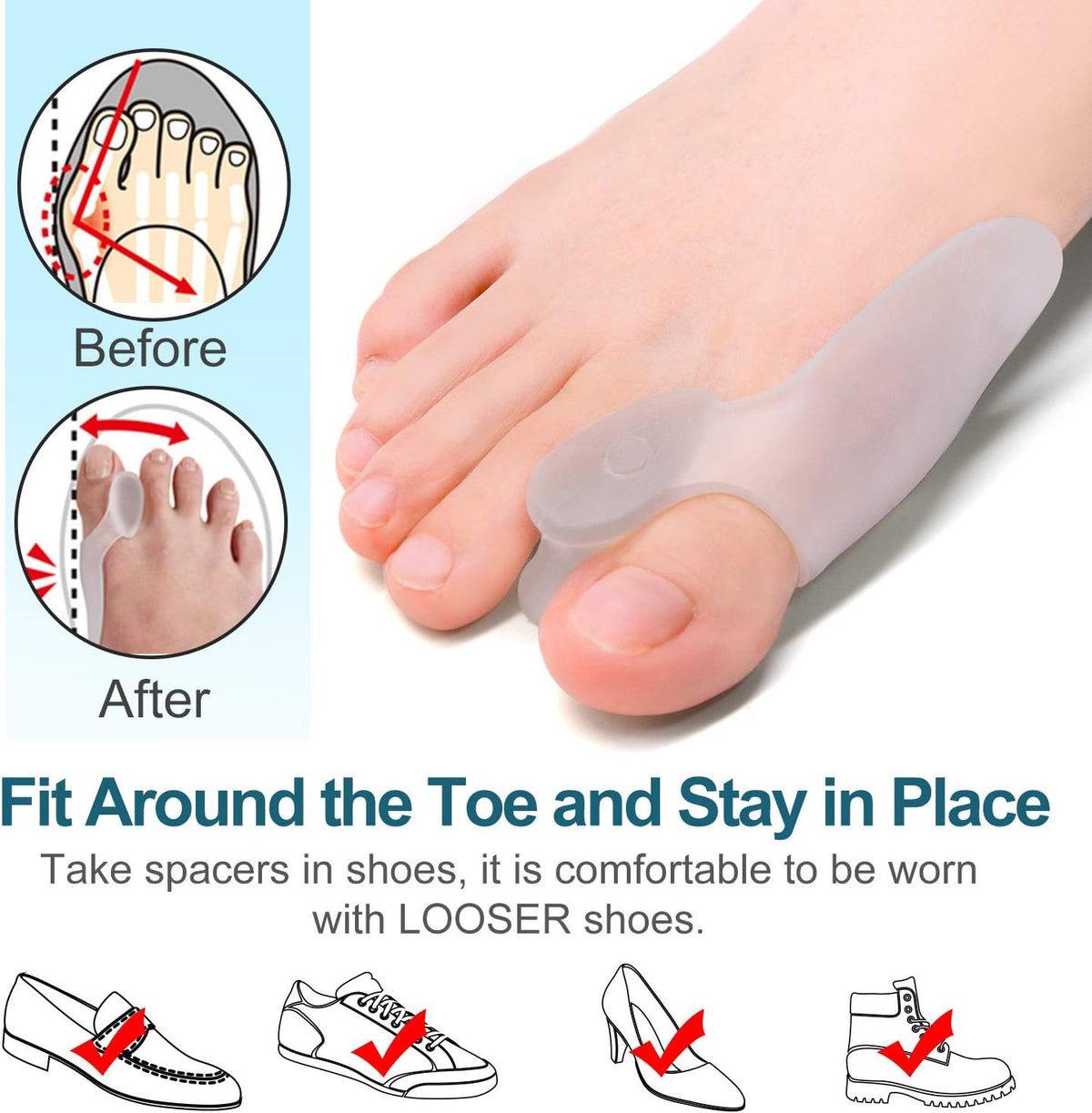 Povihome 10 Pack Clear Toe Spacers, Big Toe Separator (1st/2nd Toe), Bunion Corrector to Correct Big Toe Bunion, Overlapping Toes
