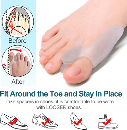 Povihome 10 Pack Clear Toe Spacers, Big Toe Separator (1st/2nd Toe), Bunion Corrector to Correct Big Toe Bunion, Overlapping Toes