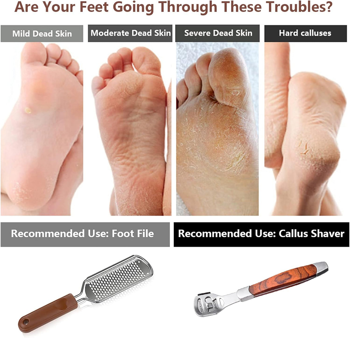 2 Pack Pedicure Kit, Foot File Callus Remover, Heel Scraper for Feet