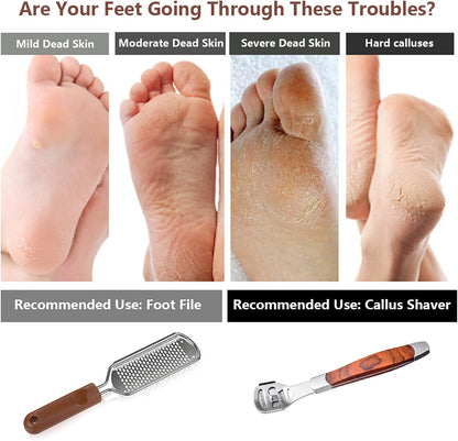 2 Pack Pedicure Kit, Foot File Callus Remover, Heel Scraper for Feet