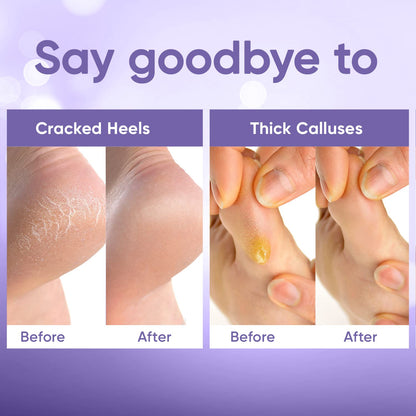 CÉLOR Foot Peeling Mask for Dry Cracked Feet | Foot Mask to Exfoliate Rough, Cracked, Dry Feet, Calluses for Soft Baby Feet Results | Made with Aloe Vera Extract for Women & Men (2 Pairs) | Lavender