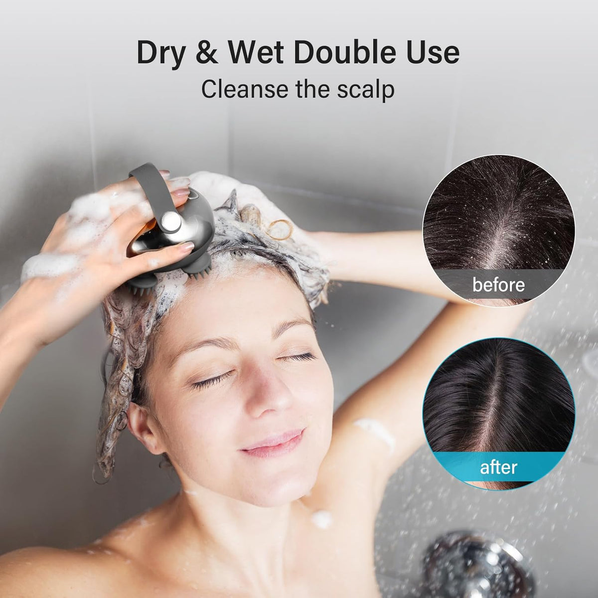 arboleaf Electric Scalp Massager Head Massager Scalp Stress Relax