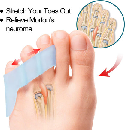 Povihome 10 Pack Pinky Toe Separator and Protectors for Overlapping Toe, Curled Pinky Toes - Spacers for Morton's Neuroma Pain Relief