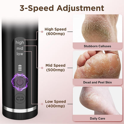 Electric Foot Callus Remover with Nano-Glass Head & 60Pcs Sandpaper Discs, 4 Hours Run Time, Electric Callus Remover for Feet with 3 Adjustable Speeds, Pedicure Tools for Dry Dead Skin Cracked Heels