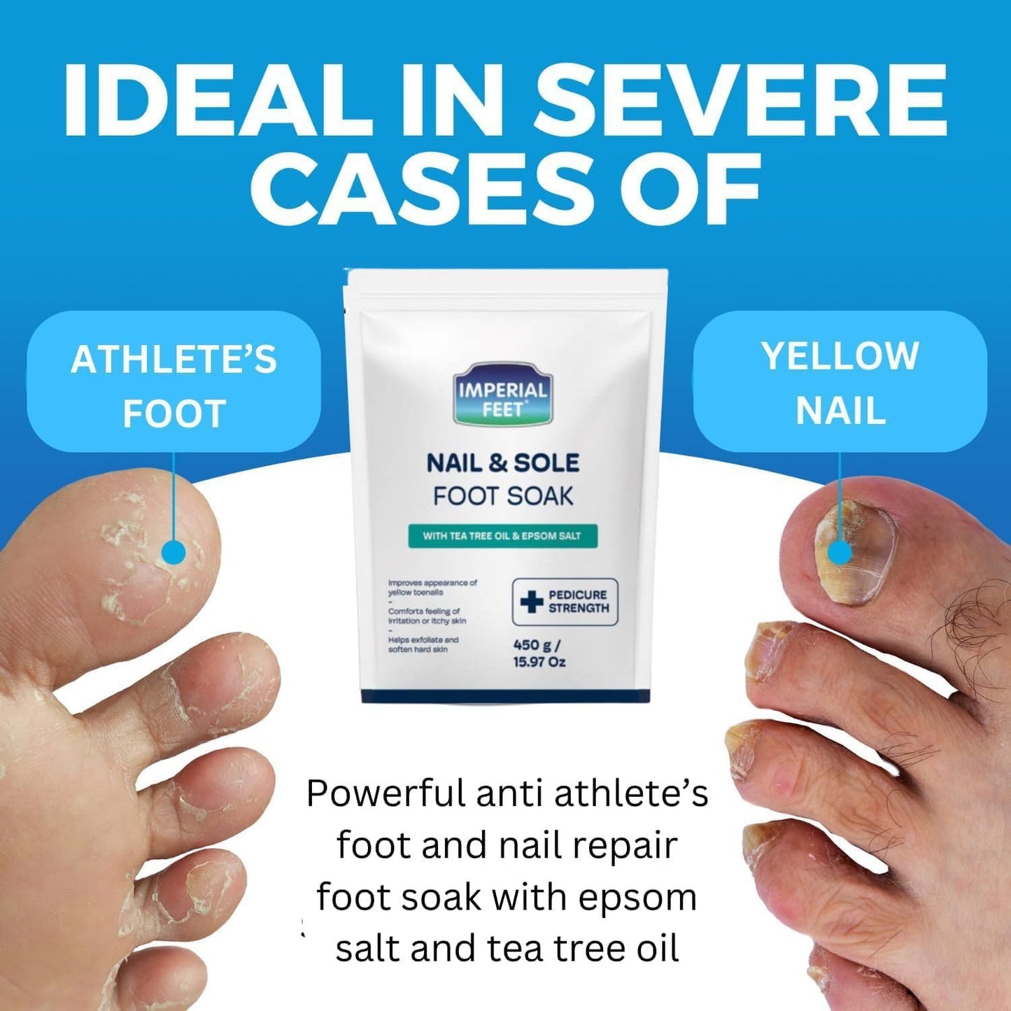 Imperial Feet Epsom Salt Foot Soak (PEDICURE GRADE)-Toenail Repair, Fungus Athletes Foot, Softens Calluses, Tired Feet & Nail Discoloration Foot Soak Salts with Tea Tree Oil 16oz (Green Fungal)