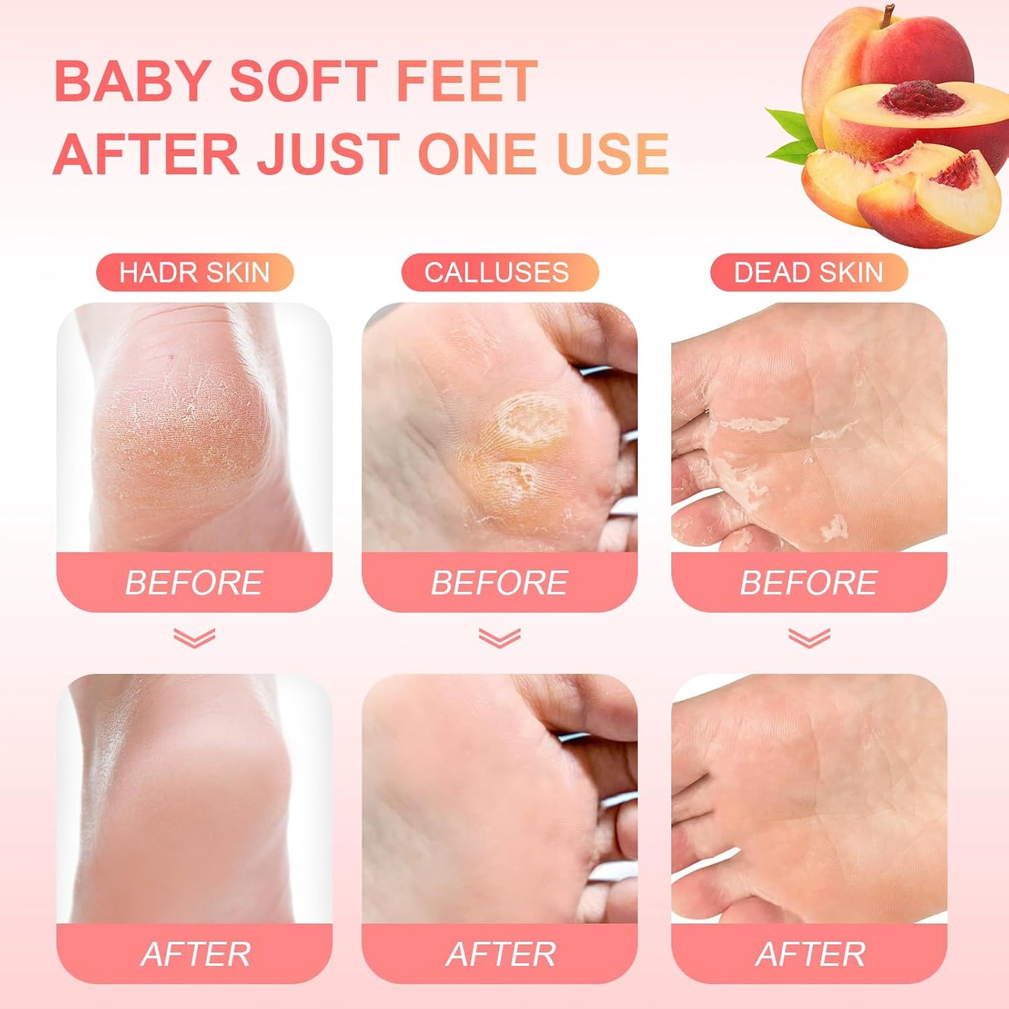 Foot Peeling Mask (5 Pack) Exfoliant for Peeling Off Calluses, Natural Exfoliator for Dry Dead Skin, Callus, Repair Rough Heels Soft Smooth Touch