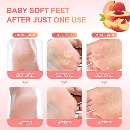 Foot Peeling Mask (5 Pack) Exfoliant for Peeling Off Calluses, Natural Exfoliator for Dry Dead Skin, Callus, Repair Rough Heels Soft Smooth Touch