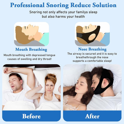 2 Pack Anti Snore Chin Strap for Sleeping, Jaw Tape Mouth Snoring Sleep Devices Stopper, Cpap Users Breathing Head Mouthpiece Solution Keep Closed, Mandibular Advancement Reducing Aids Men Women
