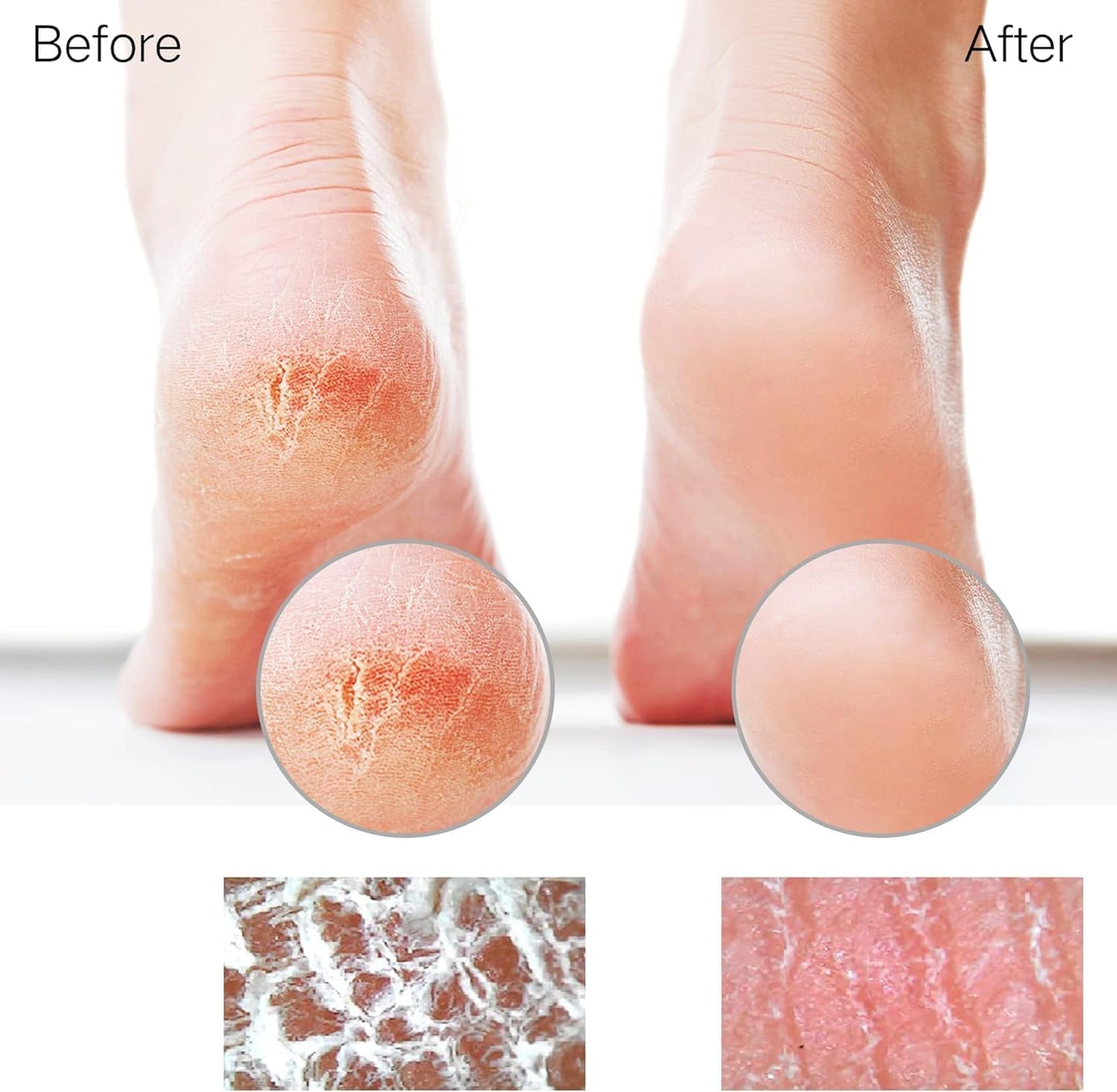 Glass Foot File Callus Remover for Feet, Heel Scraper, Pumice Stone, Diabetic Feet Scrubber Dead Skin Remover for Feet Professional Pedicure Tools | Diabetic Foot Scrubber | Nano-Glass | Safe, Effective Yet Gentle | Seamless ,Hygienic, Durable