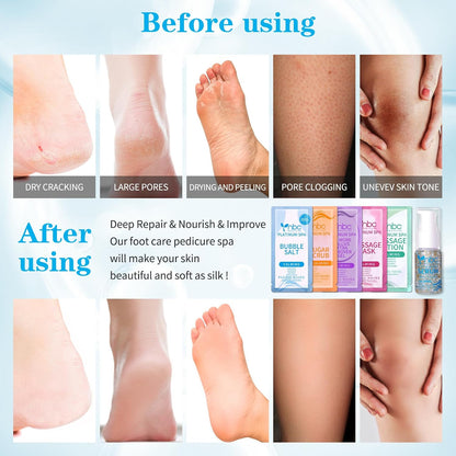 Pedicure Kit Foot Soak Set: Bubble Salt, Sugar Scrub, Massage Mask, Massage Lotion in a Box, 4 Step Foot Spa Kit for Dry Feet, Softens Calluses, Tired Feet（3 Set Lavender) - Colors A