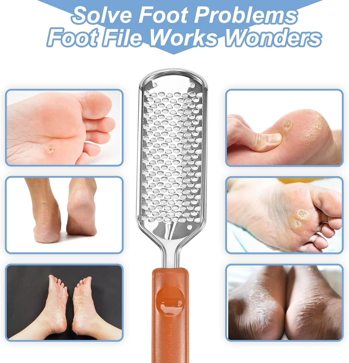 Professional Foot Scrubber Dead Skin Remover, Pedicure Foot File Callus Removal, Heel Scraper for Cracked Heels, Microplane Cheese Grater for Feet, Foot Rasp for Hard Skin(T1)