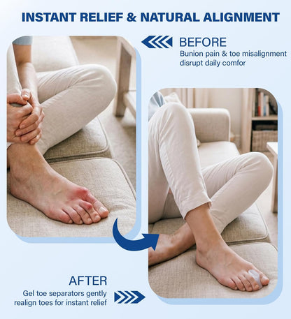 12 Pack Gel Toe Separators & Spacers - Aloe Infused Bunion Pads for Overlapping Toes, Hammer Toes & Big Toe Alignment - Medical Grade Toe Straightener for Men & Women, Transparent & Washable (M)