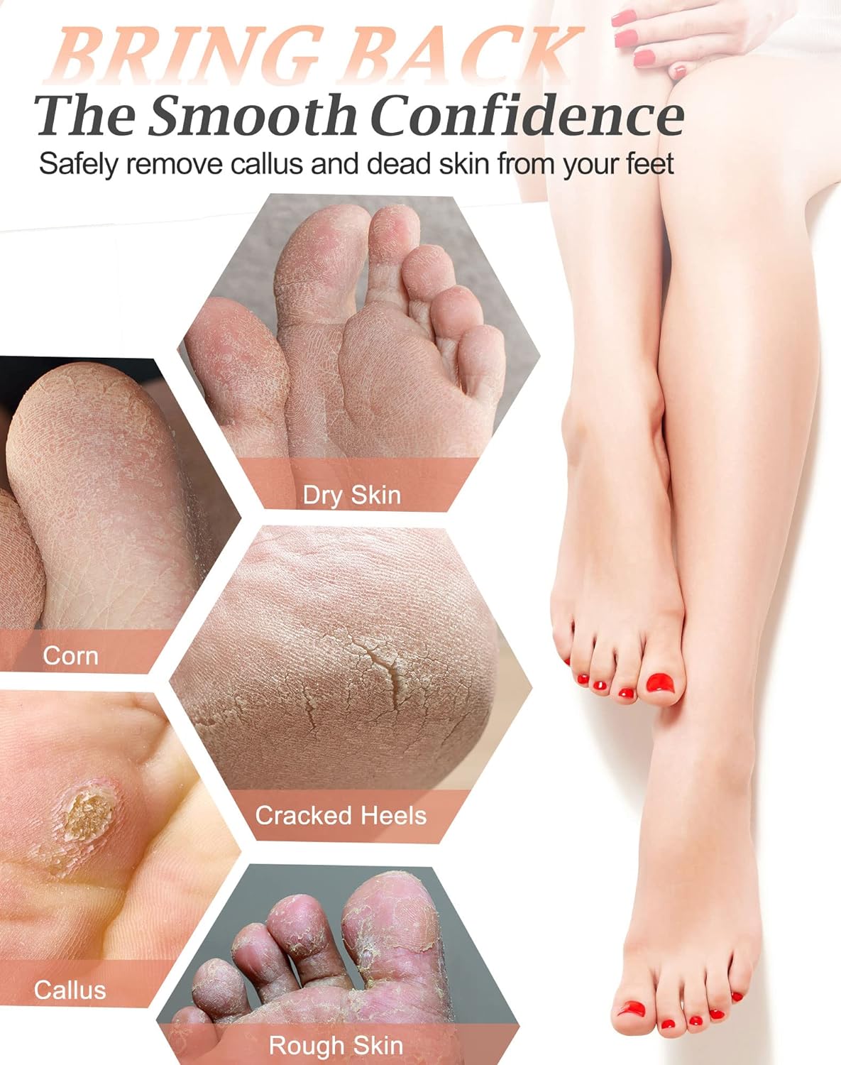 Maryton Foot Pumice Stone for Feet Hard Skin Callus Remover and Scrubber (Pack of 4) (Blue)