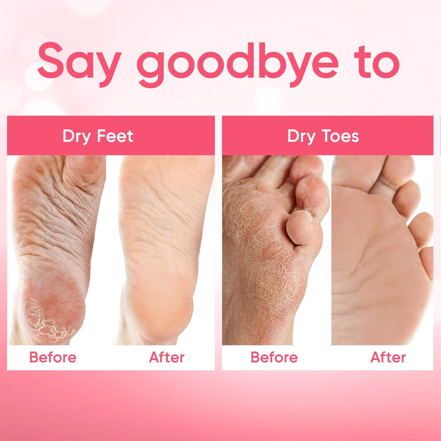 CÉLOR Foot Peeling Mask for Dry Cracked Feet | Foot Mask to Exfoliate Rough, Cracked, Dry Feet, Calluses for Soft Baby Feet Results | Made with Aloe Vera Extract for Women & Men (2 Pairs) | Lavender
