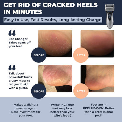 Electric Callus Remover: Rechargeable Electronic Foot File CR900 by Own Harmony (Powerful Motor) Best Pedicure Tools w 3 Rollers Professional Pedi Feet Care Sander for Cracked Heels and Hard Skin