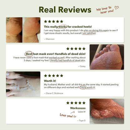 Purederm Foot Peeling Mask for Dry Cracked Feet, Exfoliating Treatment for Dead Skin & Calluses for Baby Soft Feet, 3 Pairs