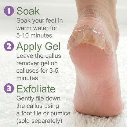 Dr. Entre's Callus Remover Gel Kit for Feet: Foot File, Pumice Stone, 5 Glove Pairs for Gel Application, Spa Kit, Foot Care, Pedicure Tools, Scrubber, 8oz