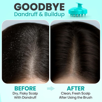 RELAXXO Scalp Massager Hair Growth – Exfoliator & Hair Scrubber for Scalp, Soft Bristles for Dandruff & Soothing Comfort, Shampoo Brush, Wet & Dry Use, Pink