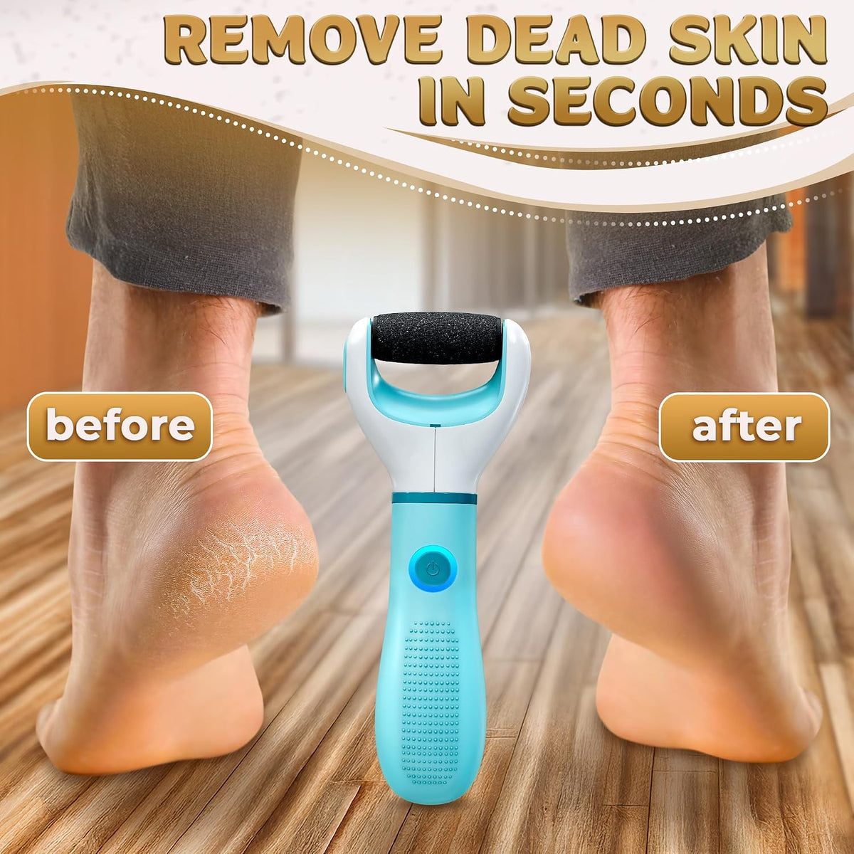 Battery Operated Foot Callus Remover for Dead Skin, Exfoliating Tool