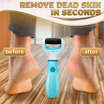 Battery Operated Foot Callus Remover for Dead Skin, Exfoliating Tool