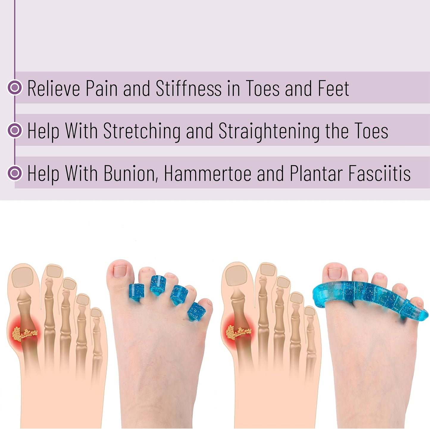 DR. JK- ToePal Gel Toe Separator, 2 Pairs, Toe Spacers, Toe Straightener, Hammer Toe Straightener, Toe Spreader, Toe Stretcher, Toe Corrector for Women and Men, Bunion Corrector