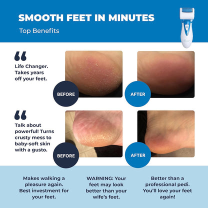Electric Callus Remover: Rechargeable Electronic Foot File CR900 by Own Harmony (Powerful Motor) Best Pedicure Tools w 3 Rollers Professional Pedi Feet Care Sander for Cracked Heels and Hard Skin
