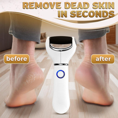 Electric Foot Callus Remover Tool for Dead Skin & Cracked Heels – Battery-Operated Foot Grinder with Replaceable Roller – Pedicure Tools for Feet & Toes – Smooth Feet at Home (Batteries Not Included)