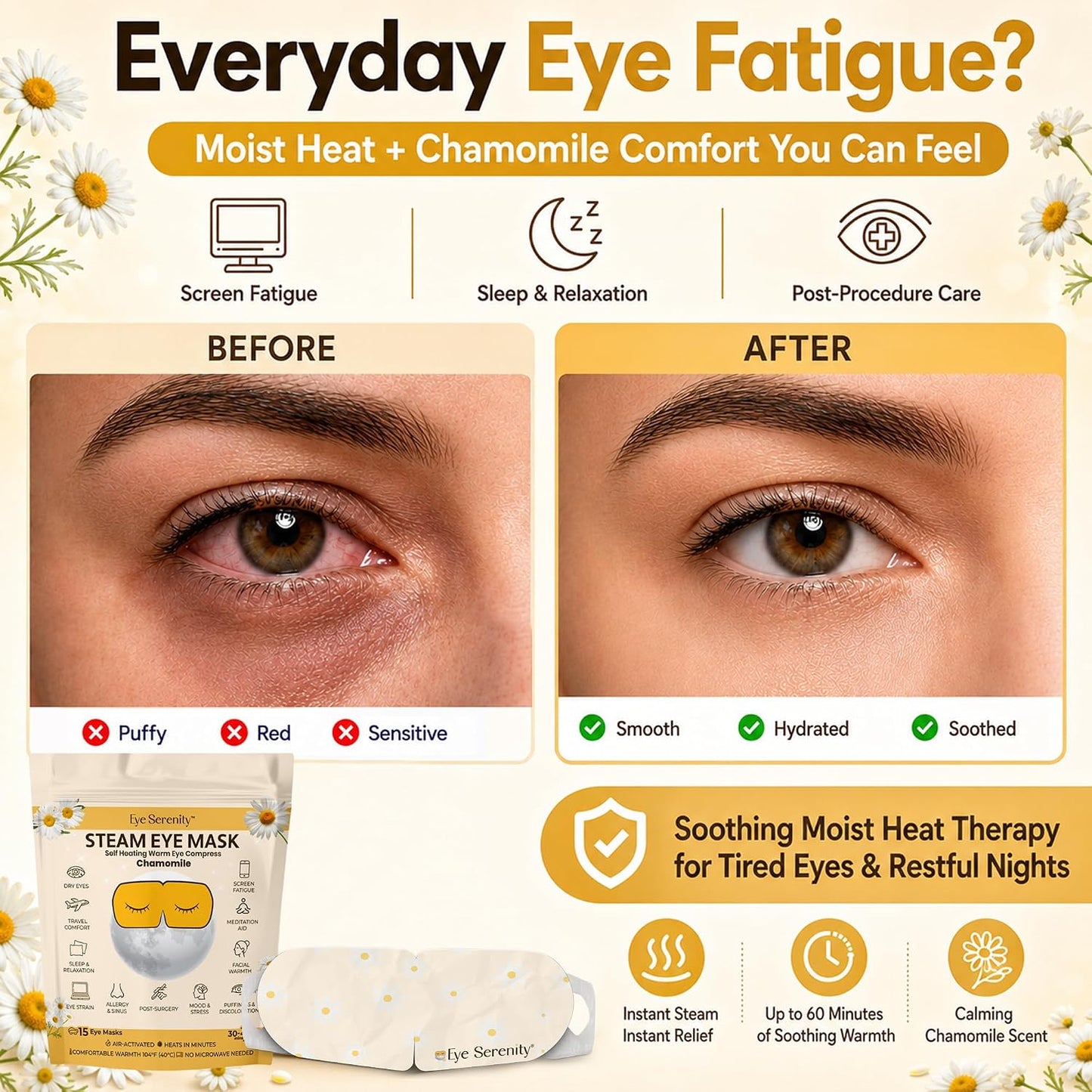 Eye Serenity Steam Eye Mask, Heated Eye Mask, Self Heating Warm Compress for Dry Eyes, Fast Relief for Stye, Puffy Sensitive Eyes, Moist Heat, Gift for Women and Men - Unscented