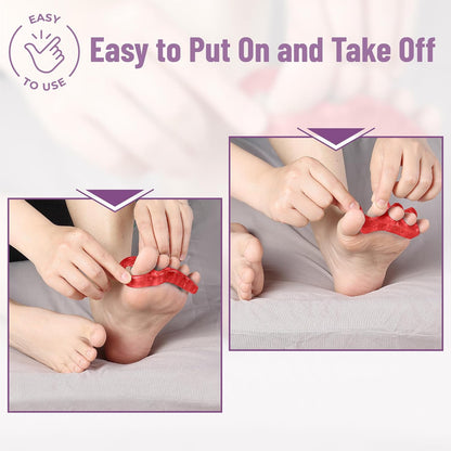DR. JK- ToePal Gel Toe Separator, 2 Pairs, Toe Spacers, Toe Straightener, Hammer Toe Straightener, Toe Spreader, Toe Stretcher, Toe Corrector for Women and Men, Bunion Corrector